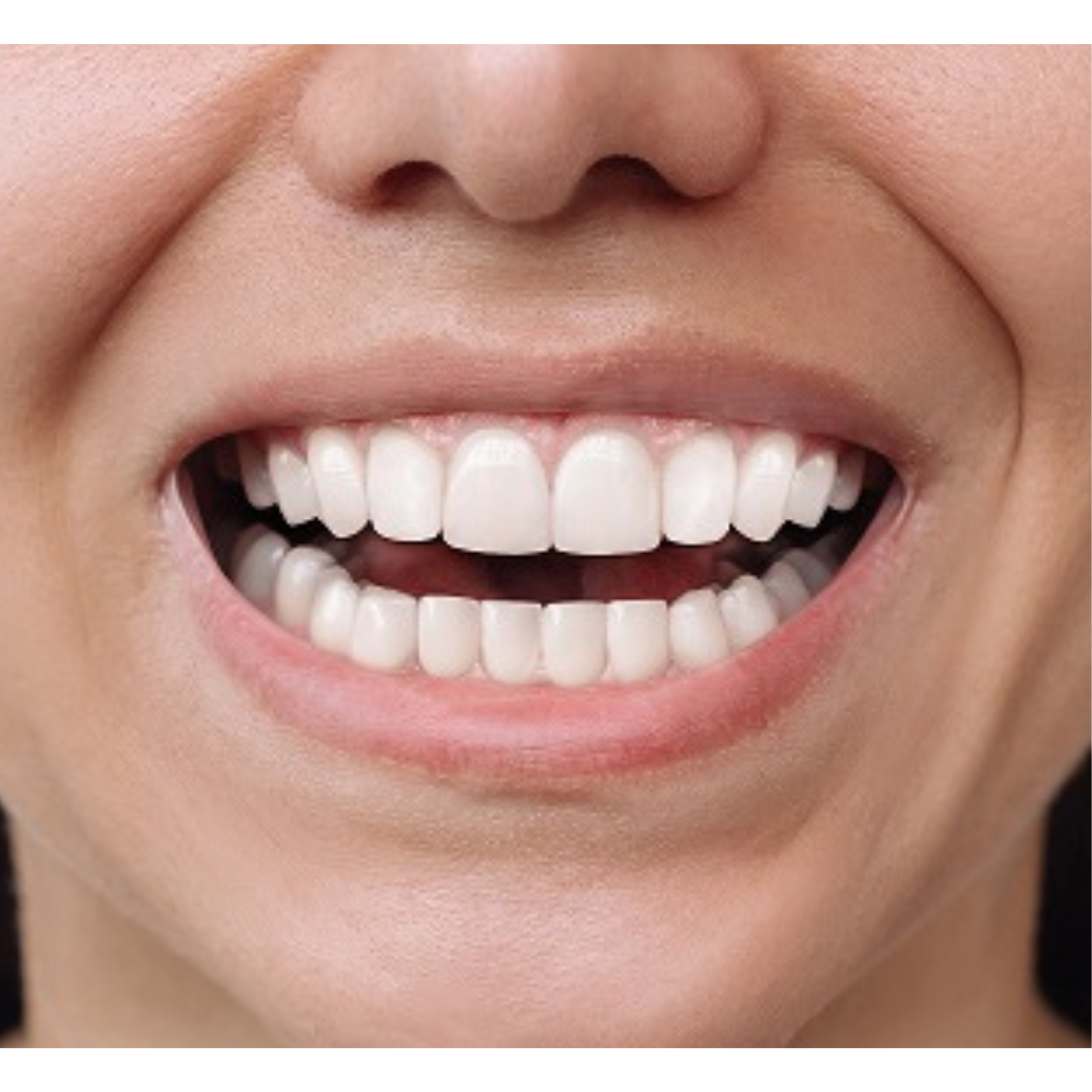 Clear Aligners | KPS Dentalcare