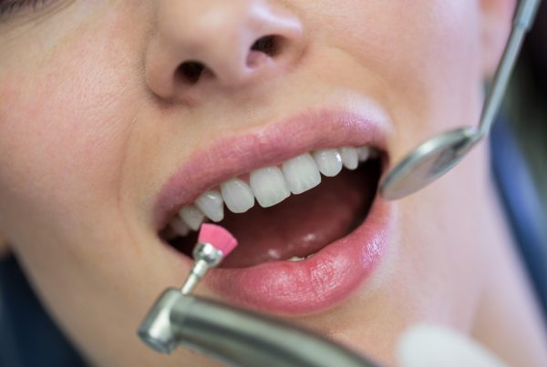 Bleeding Gums: Causes, Treatment & Prevention | KPS Dentalcare