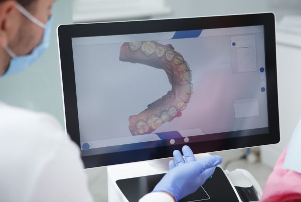 3D Intraoral Scanner – Faster Digital Scanning KPS Dentalcare