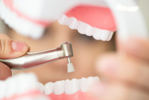 Polishing And Scaling – Dental Cleaning & Care | KPS Dentalcare