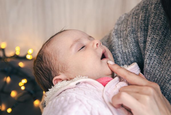 Tongue Tie Newborn – Electrocautery Treatment | KPS Dentalcare